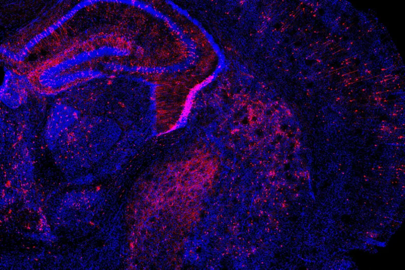 Researchers applied the Perturb-Seq method to the developing mouse brain by introducing multiple genetic changes to cells (in red) and measuring how gene expression changed in individual cells.