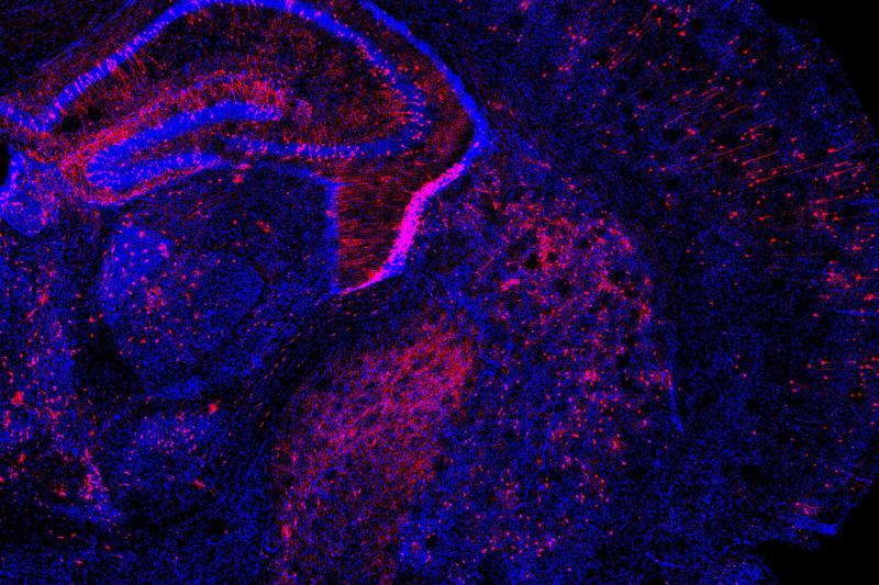 Researchers applied the Perturb-Seq method to the developing mouse brain by introducing multiple genetic changes to cells (in red) and measuring how gene expression changed in individual cells.