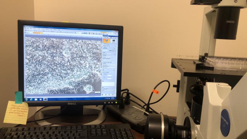 Microscope and computer for image analysis
