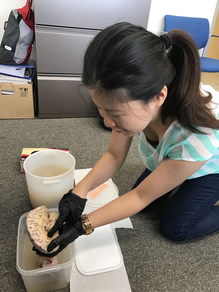 Student holding preserved brain.