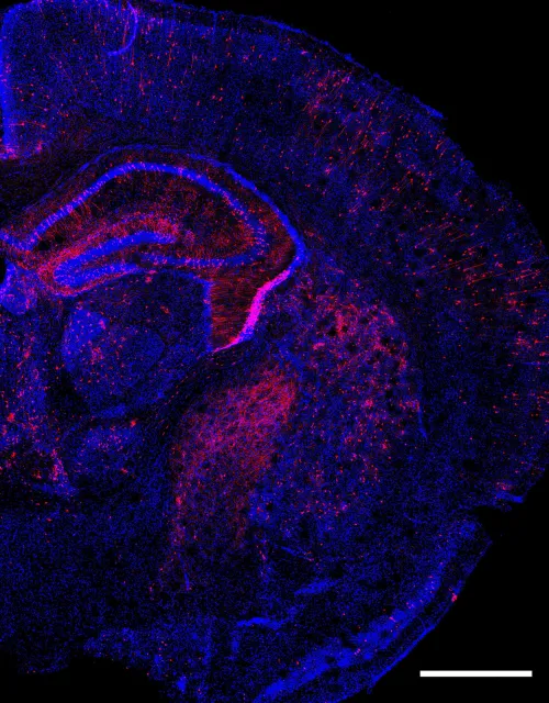 Researchers applied the Perturb-Seq method to the developing mouse brain by introducing multiple genetic changes to cells (in red) and measuring how gene expression changed in individual cells.