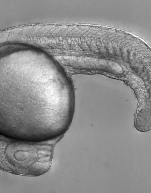 Zebrafish embryo that models anemia, with a defective transcription factor protein that leads to an inability to produce red blood cells.