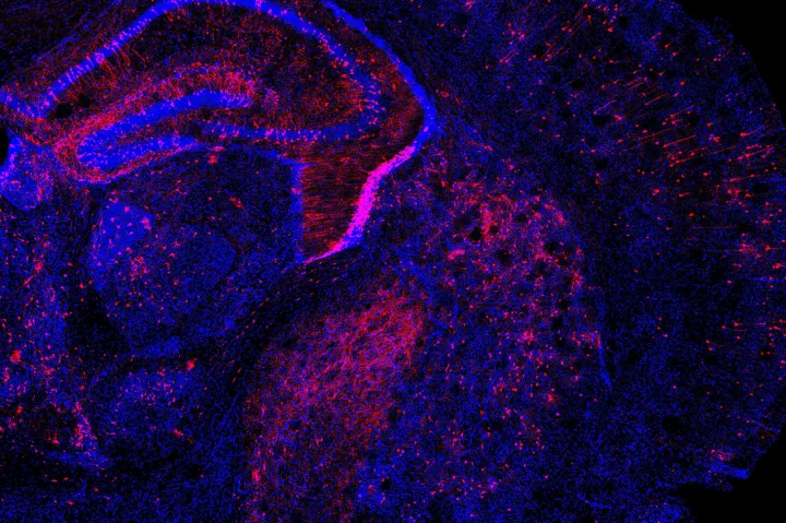Researchers applied the Perturb-Seq method to the developing mouse brain by introducing multiple genetic changes to cells (in red) and measuring how gene expression changed in individual cells.